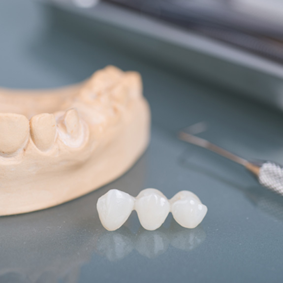 A dental bridge in front of model teeth next to dental instrument on reflective surface